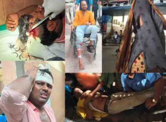 Violence Erupts During Teachers’ Protest at Bikash Bhavan: Severe Injuries, Allegations of Police Brutality